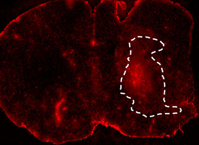 Micrograph with outlined tumor for test of blood-brain barrier integrity in mouse pretreated with bevacizumab plus injection of Texas Red dextran
